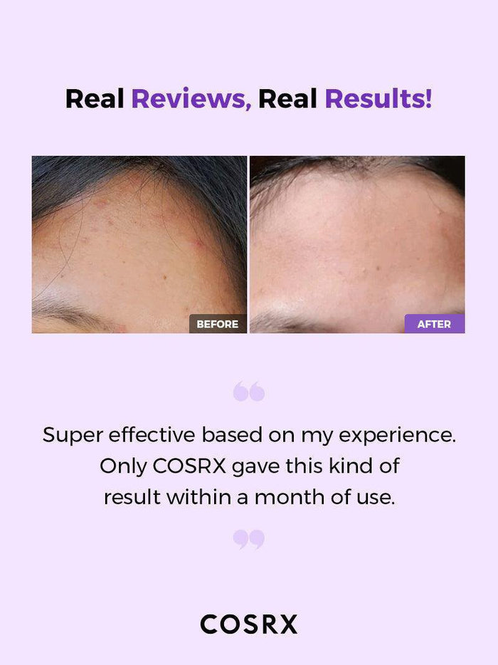 Cosrx AHA/ BHA Clarifying Treatment Toner 150 ML